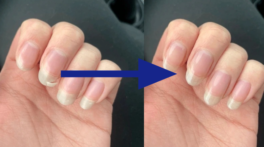 fix broken fingernails